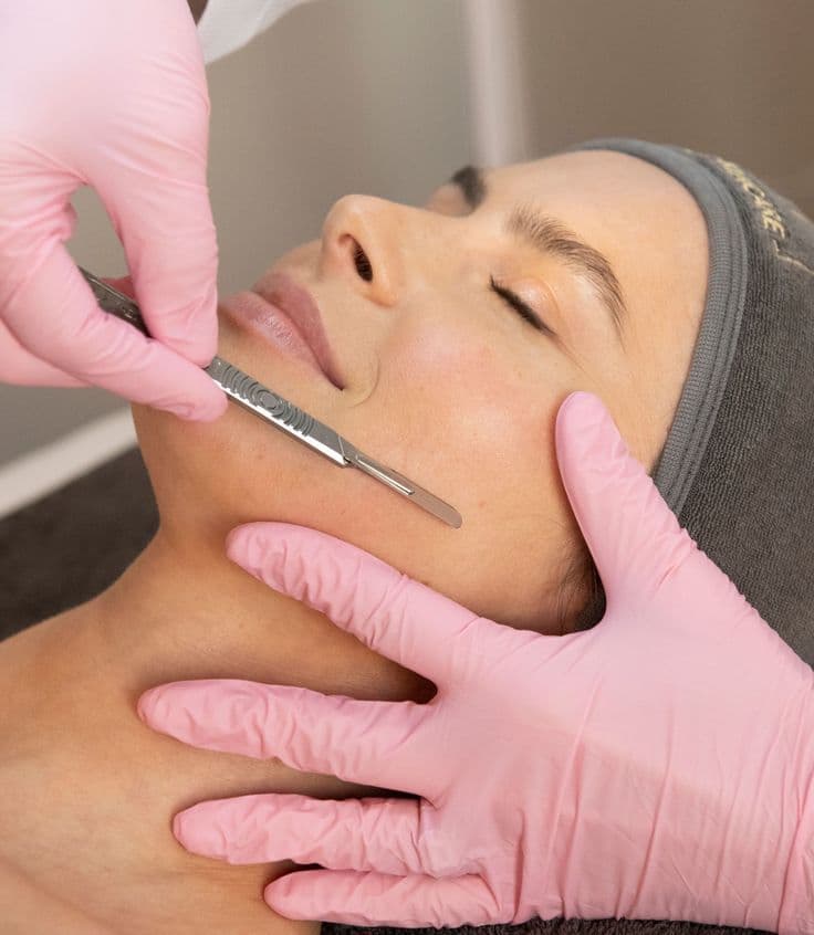 Dermaplaning treatment at Diamond Laser Centre Mauritius