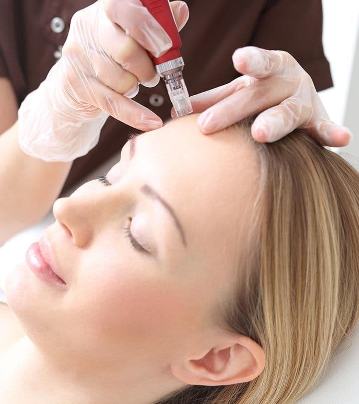 Mesoneedling treatment at Diamond Laser Centre Mauritius