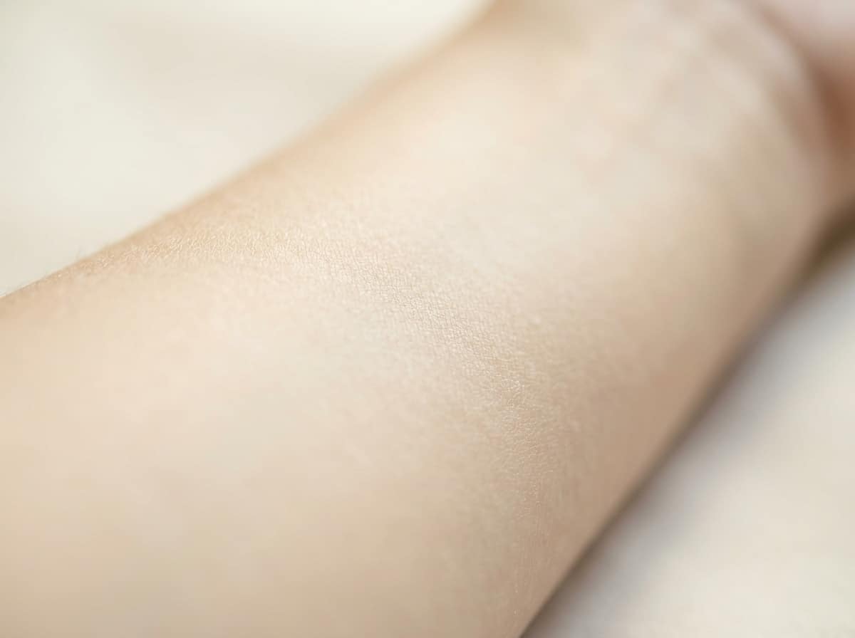Laser Hair Removal